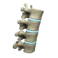 Stand up and put your hands on … Facet Joint Sprain A Pain In The Back Sports Spinal Albury