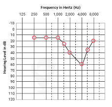 The specific amount you'll owe may depend on several things, like: Complete Guide To Getting A Hearing Test Ziphearing