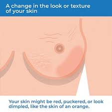 Sometimes the redness comes and goes. Breast Cancer Health Information Bupa Uk