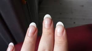 Halten die nägel dann auch und sehen. Bild Nagel Vor Auffullen Heute Nach Nagelmodellagen Reparatur