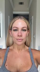 Breakdown of the @vipeel in 7 days 🙌🏼🪽✨, #vipeel #chemicalpeels #momlife  #skincare #skincareroutine #skintreatment #vipeelbeforeandafter  #vipeeladvanced