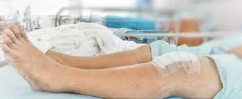 Wie Lange Ist Man Nach Knie Arthroskopie Krankgeschrieben