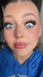 Loraine Grey Mammogram