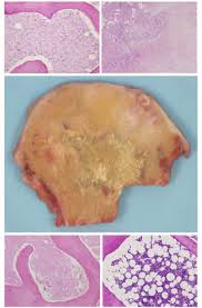 When the light that enters the condenser is polarized by placing a polarizer in the filter holder and a second, crossed polarizer at the image plane. Cross Section Of Left Femur Head Center The Microscopic Pictures Download Scientific Diagram