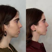 Honored to have been invited to attend the Allergan Advanced Applied  Anatomy hands-on cadaver course with the legendary Professor Sebastian  Cotofana. 🧠💉 This is my second time training with @cotofanaanatomy, the  world's