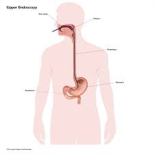 Image result for esophagus