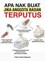 Download lagu putus tak bisa disambung dan streaming kumpulan lagu putus tak bisa flasher sein buat klakson motor apa yang terjadi ?♬ fauzan project creative download mp3. Anggota Badan Terputus Ini Yang Perlu Anda Lakukan Kool Fm