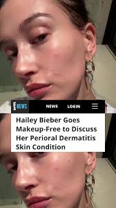 What Happened to Hailey Bieber Face