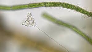 Pond water under microscope labeled. Bresser Hay Infusion Expand Your Horizon