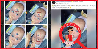 An Edited Video Falsely Shared As A Video Of Baby Born With Three Eyes Factly