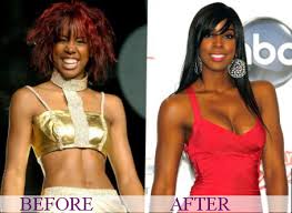 Kelly rowland nose job before & after. Celebrity Kelly Rowland Plastic Surgery Photos Video