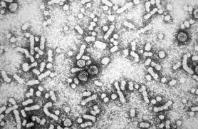 It is a major global health problem. Hepatitis B Wikipedia