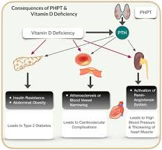 Hyperparathyroidism and Vitamin D | Dr. Babak Larian