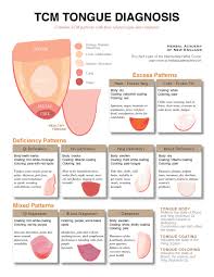 71 Veritable Tcm Tongue Diagnosis Chart