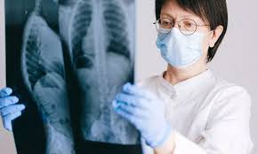 Individualized Stereotactic ablative radiotherapy may help minimize dosage  in lung tumor: JAMA