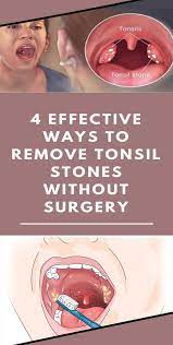 Pin On Home Remedies For Skin Care
