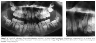 Résultat de recherche d'images pour "cleft grafting Peter"