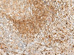 Tested in western blot (wb), immunofluorescence (if), immunocytochemistry (icc) and flow cytometry (flow) applications. H 2 Class Ii Histocompatibility Antigen A Q Alpha Chain Elisakit Net