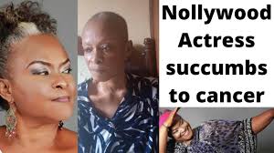 Veteran actress, ify onwuemene has cried out for help as she battles cancer. Jsk07ppkkgezzm