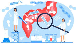 Once your cancer has been diagnosed and staged, there is a lot to think about before you and your physicians select a treatment plan. H Pylori And Your Stomach Cancer Risk Md Anderson Cancer Center