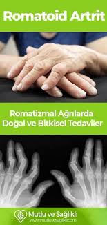 Romatoid Artrit Romatizmal Agrilarda Dogal Ve Bitkisel Tedaviler Artrit Romatoid Artrit Dogal