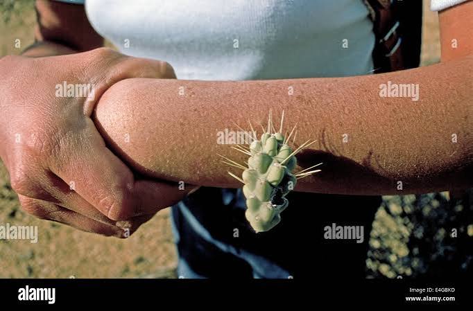 A woman shows the arm where spines of a jumping cholla cactus have painfully pierced her skin while hiking in the desert near Tucson, Arizona, USA Stock Photo - Alamy