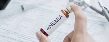 Yes, due to the fact that iron contributes to the production of hemoglobin (the ability to deliver nutrients and oxygen to certain cells in your body) hair loss can be caused by anemia. Does Anemia Cause Hair Loss Clinicana