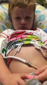 Grayson has a virus and bacteria (MSSA, which a form of staph) in his  blood. This is day 4 in the hospital with 12 more days left. He's feeling  much better right