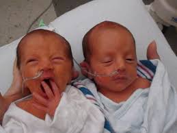 Just 14 short years ago we had tiny babies in the NICU. Now you call me  “shrimpy” and your friends at school call you the “Twin Towers”. I am so  proud of