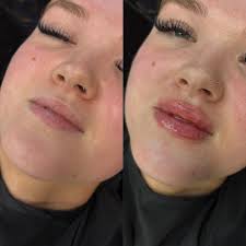 Hairstylist and Cosmetic Injector Services in Athens