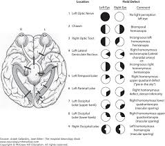 approach to acute visual changes abnormal eye movements