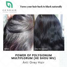 Onion juice is interesting for how it offers a strong scent, but it is more than just something your nose it allows blood to move well enough to allow the follicles to feel naturally restored. Reverse Gray White Hair And Hair Growth With Polygonum Multiflorum