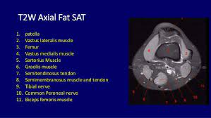 General anatomy and musculoskeletal system. Mri Anatomy Of Knee Dr Muhammad Bin Zulfiqar