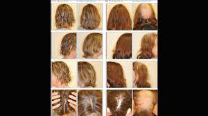 Can wearing a cold cap during chemotherapy stop you losing your hair? How Some Women Avoid Hair Loss During Chemotherapy Cnn