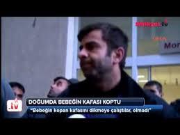 dogumda bebegin kafasi koptu youtube