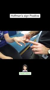 Image result for Hoffman Sign