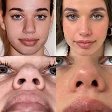 THOMAS W LOEB, MD PC