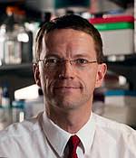 Cellular Therapy and Stem Cells for Familial Focal Segmental Glomerulosclerosis (fFSGS): :Advances in understanding genetic mutations associated with FSGS led to targeted therapies aimed at specific genetic abnormalities, providing new avenues for treatment in genetically predisposed individuals.

