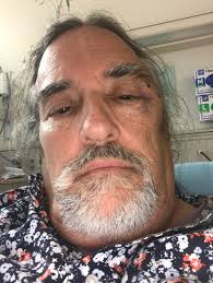 UPDATE: I want to thank Chris GS for being right there with me the entire  time after my fall. Doc Schwartz for his medical expertise, Dylan O'Donnell  for his encouraging words, Breen