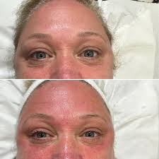 Joanne Fuller Beauty & Aesthetics