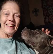 Woke up with swollen and painful legs