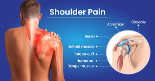 Image result for Shoulder Pain