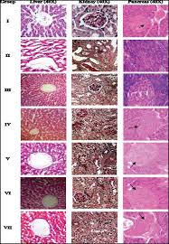 Image result for Rubus steudneri