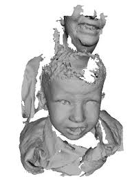 Shape-based Quantification of 3D Face Data for Craniofacial Research