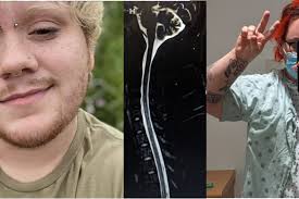 Fundraiser for Liam Fifer by Elizabeth White : Help Liam Recover from  Spinal Cord (TCS) Surgery