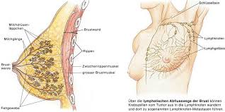 Sentinel Lymph Nodes Beim Mammakarzinom Teil 2 Mta R De
