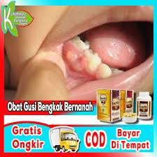 Supaya rasa nyeri dan gusi yang bengkak cepat mereda, lakukan kompres dingin dengan es batu. Obat Gusi Bengkak Bernanah Solusi Mengobati Sakit Gusi Bernanah Kapsul Membantu Penyembuhan Bengkak Gusi Ber Bpom Bengkak Radang Sakit Gigi Bengkak Benjolan Di Gigi Berlubang Gum Boil Di Pinggir Gigi Benjolan Kecil