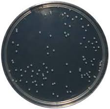 It is also used to isolate and maintain neisseria and moraxella species. Pp0963 Mueller Hinton Agar 25ml E O Laboratories Ltd