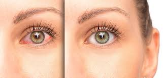 The man is first rate, both as a person and as a physician. Dry Eye Treatment San Diego Eye Care Services San Diego Eye Clinic