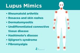 Lupus Misdiagnosis Diseases That Can Mimic Lupus Dermatomyositis is one of a group of rare muscle diseases called inflammatory myopathies, which are characterized by chronic muscle inflammation accompanied by muscle weakness.